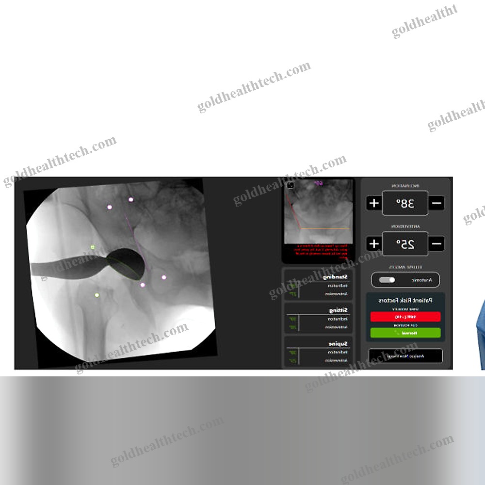 Orthopedic Surgery Surgical Navigation System