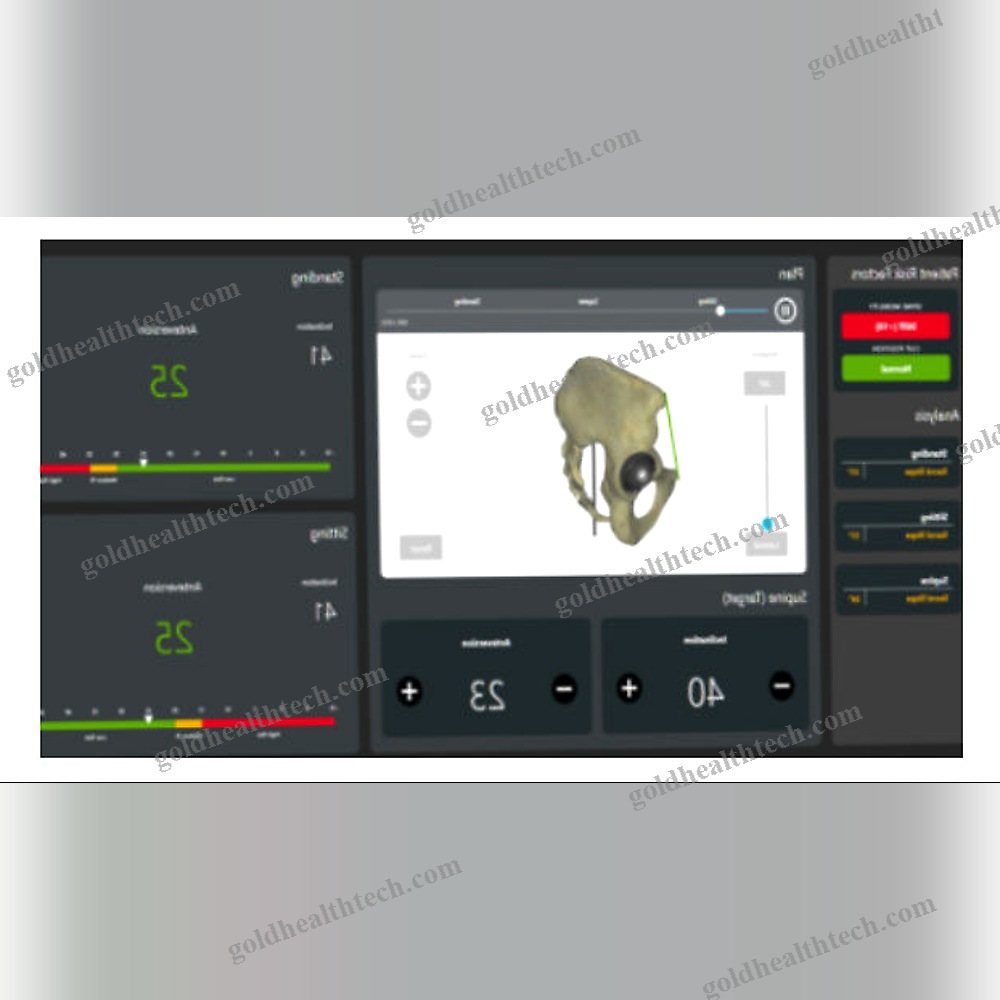Orthopedic Surgery Surgical Navigation System