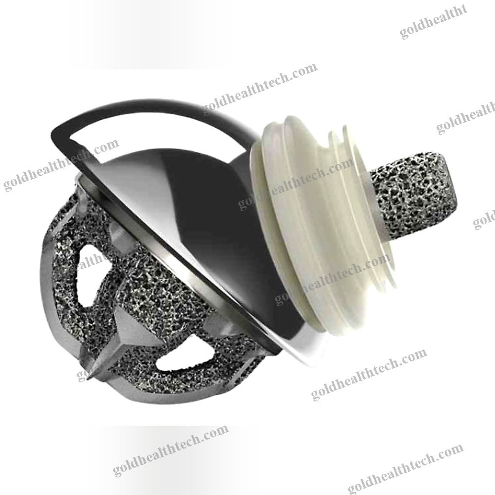 Cementless Shoulder Prosthesis