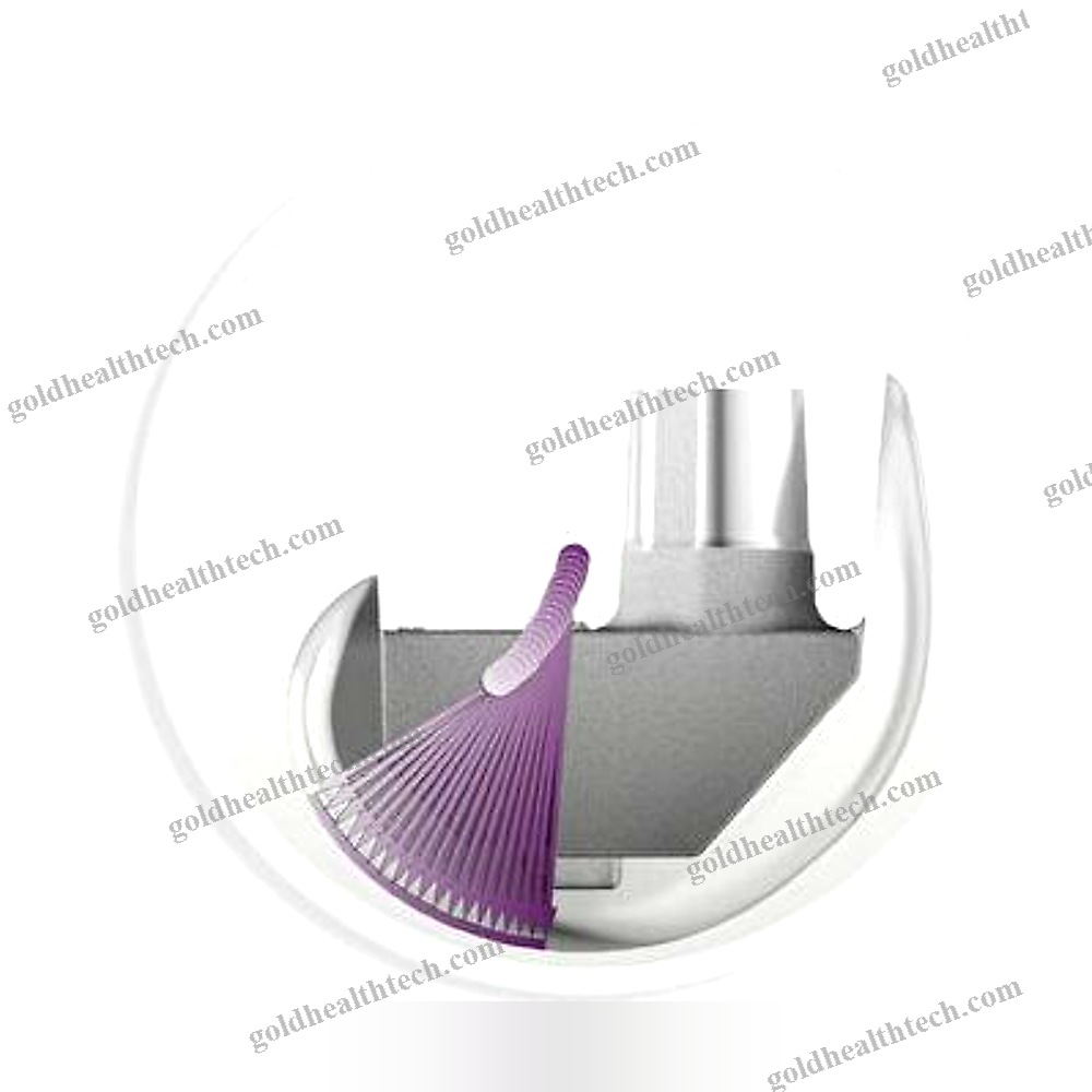 Total Knee Prosthesis