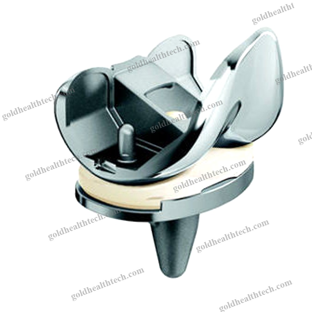 Total Knee Prosthesis