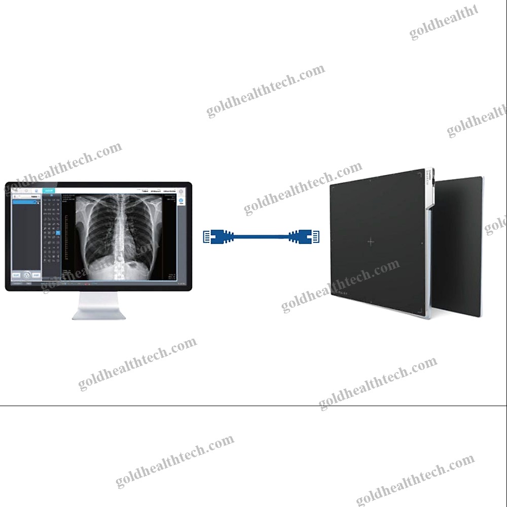 Veterinary Radiography Flat Panel Detector