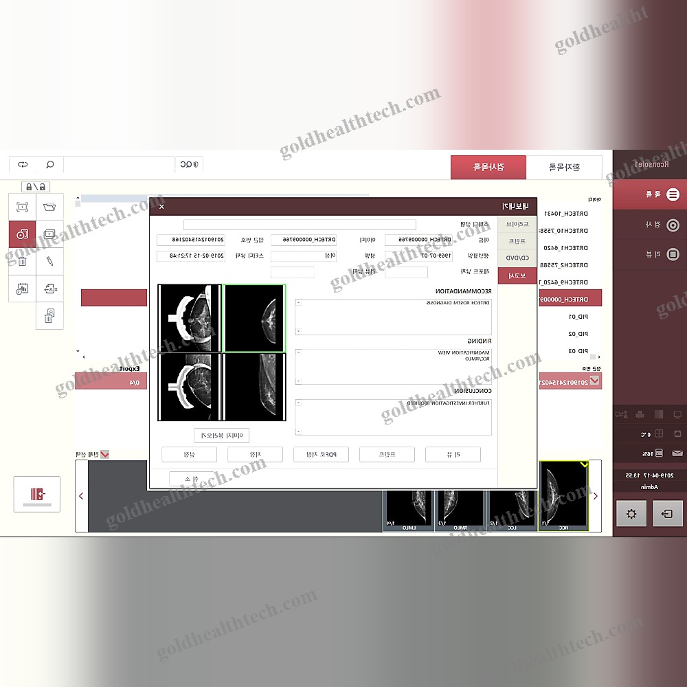 Mammography Software