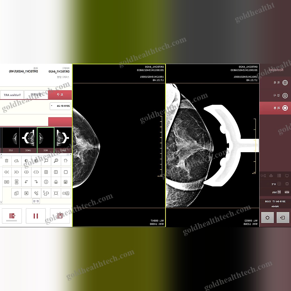 Mammography Software