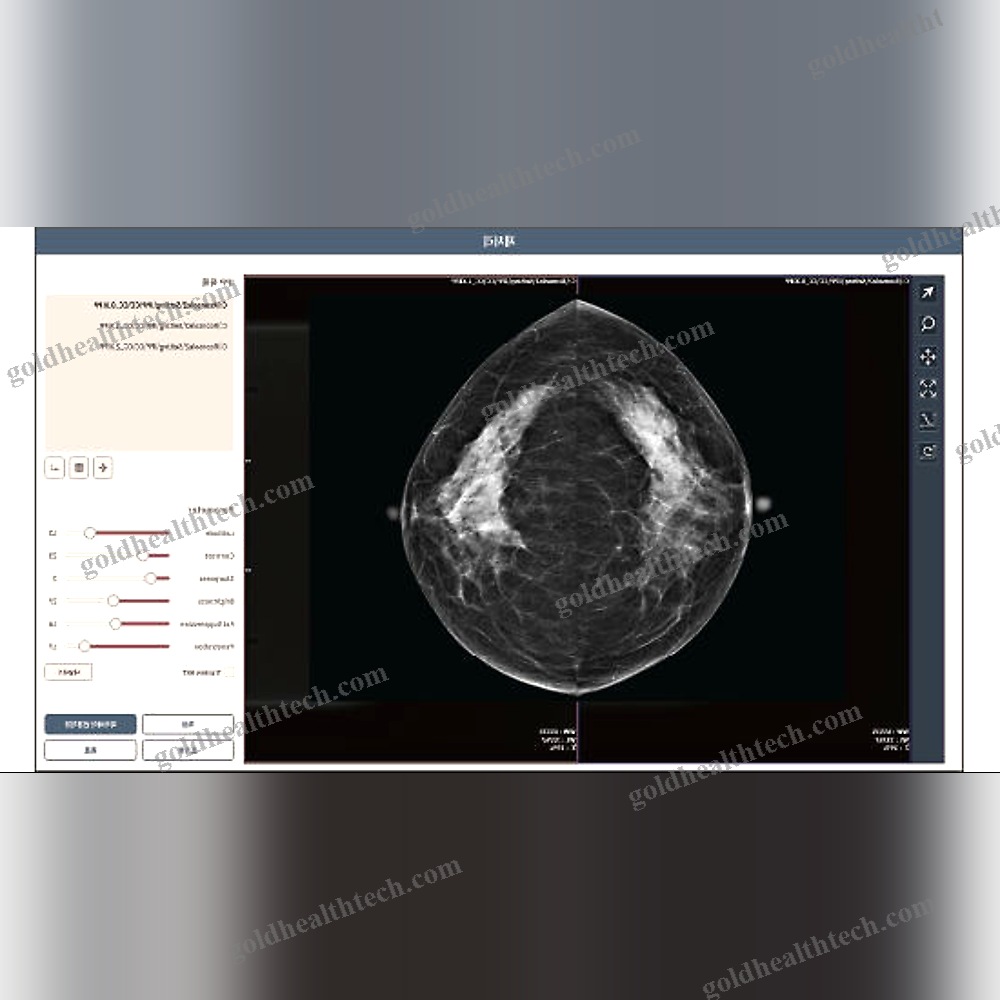 Mammography Software
