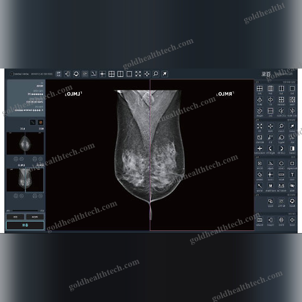 Mammography Software