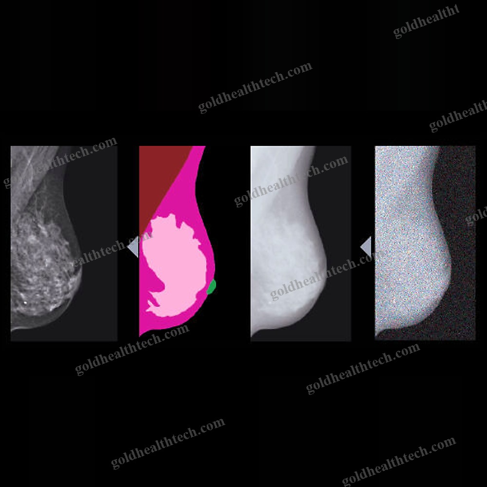 Mammography Software