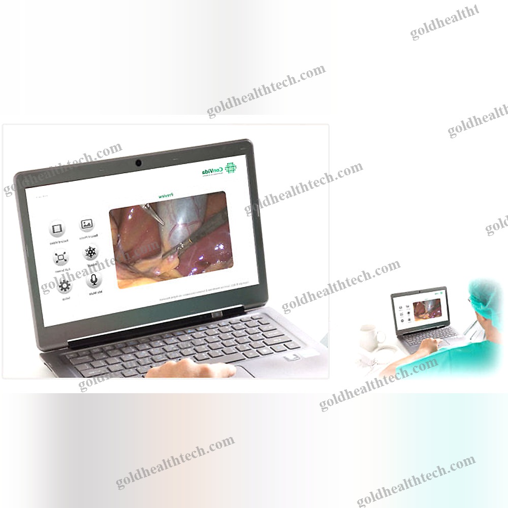 Or Video System