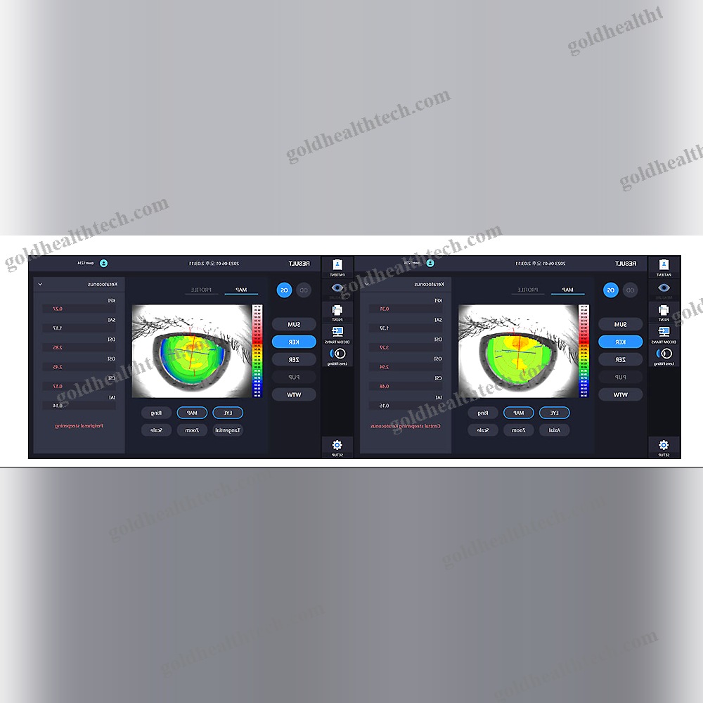 Corneal Topographer
