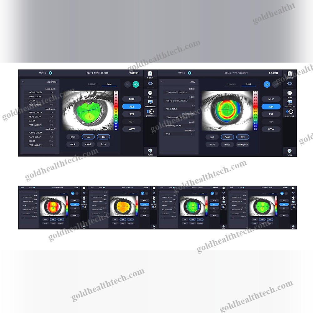 Corneal Topographer