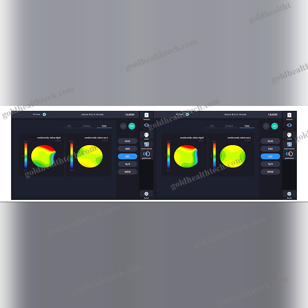 Corneal Topographer