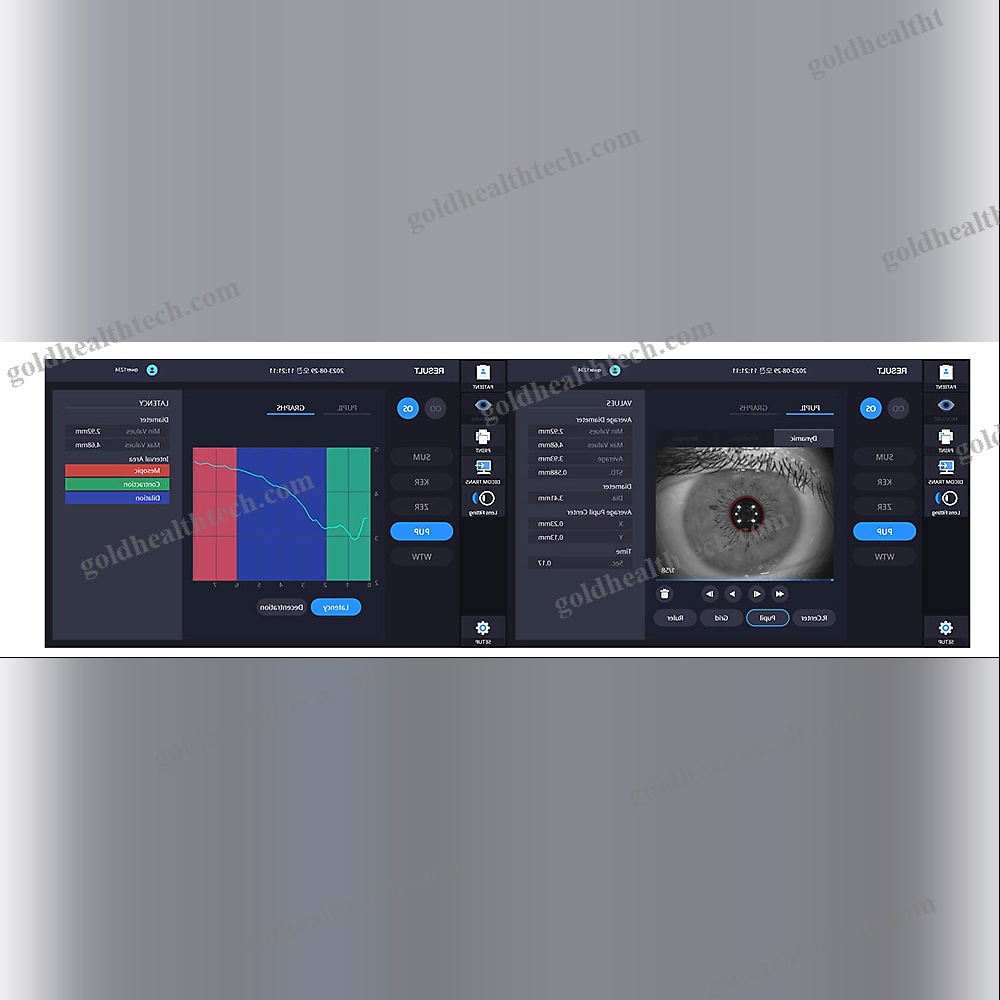 Corneal Topographer