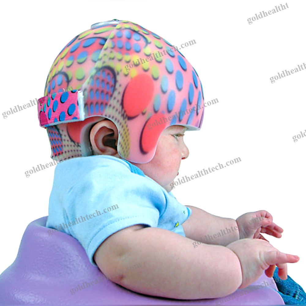 Cranial Orthosis