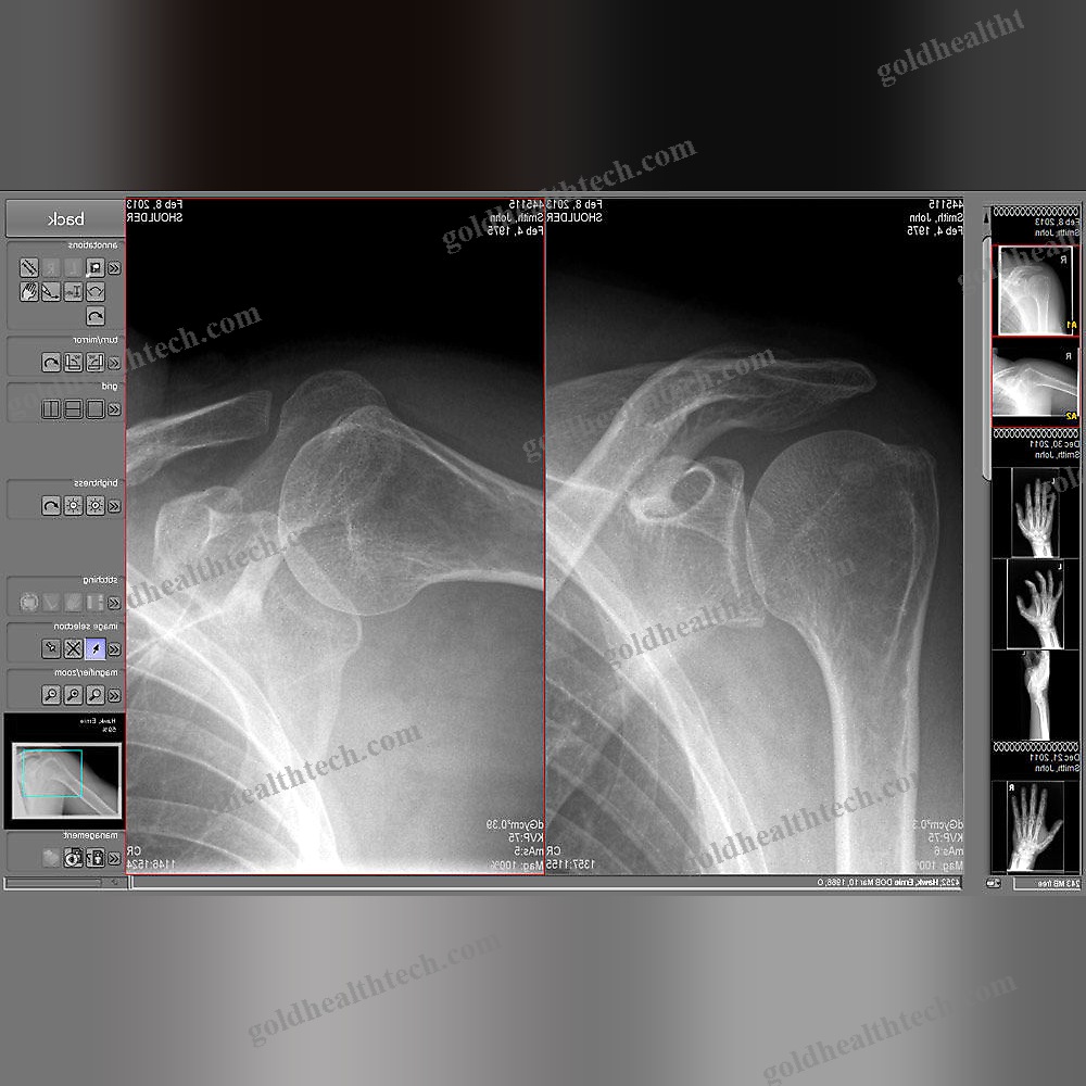 Medical Imaging Software
