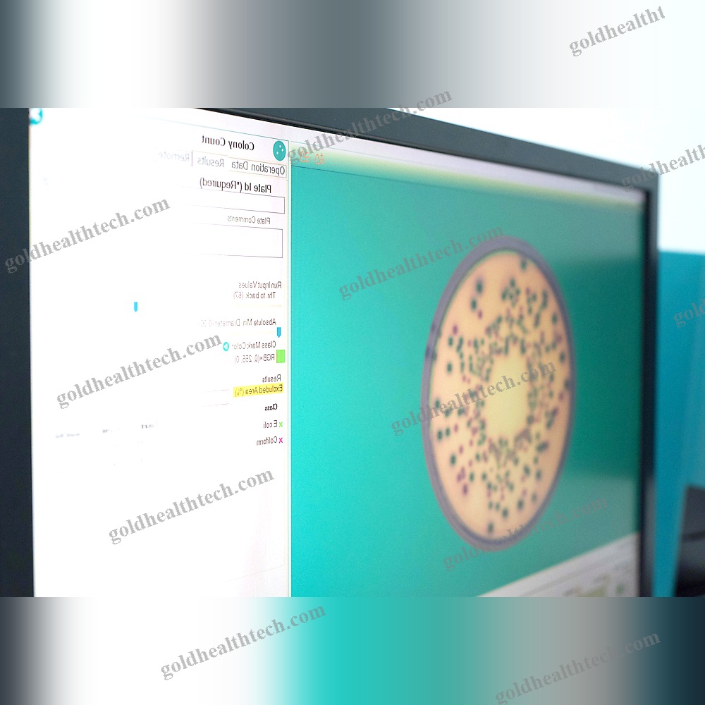 Automatic Colony Counter