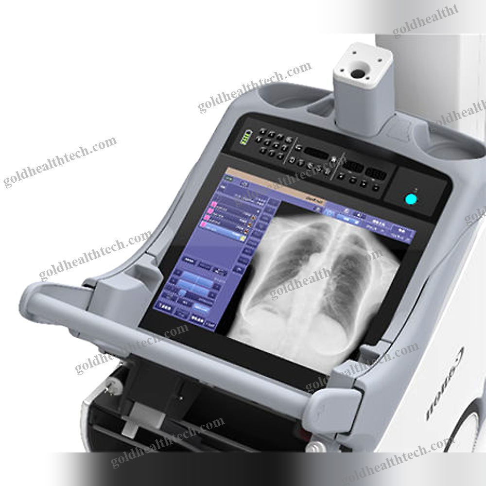 Digital Mobile Radiography Unit