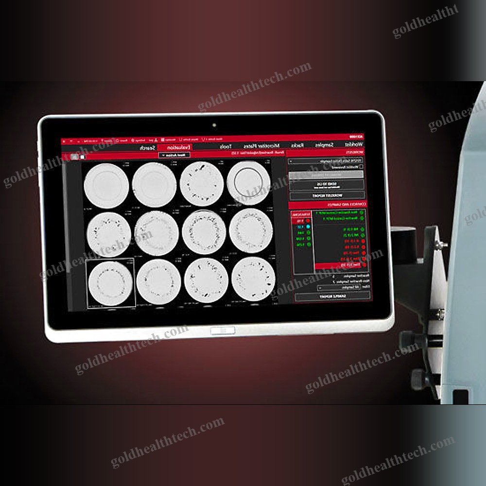 Syphilis Testing Molecular Biology Analyzer
