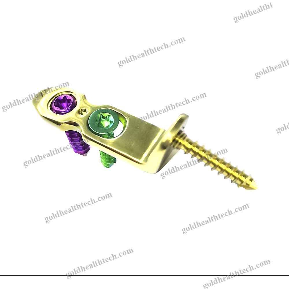 Ankle Osteotomy Plate