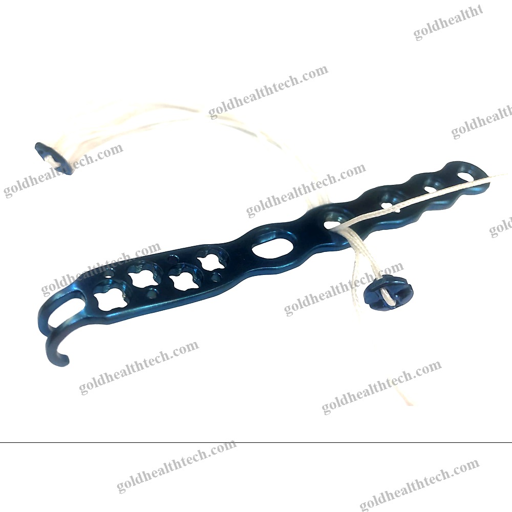 Cruciate Ligament Reconstruction Suture Button