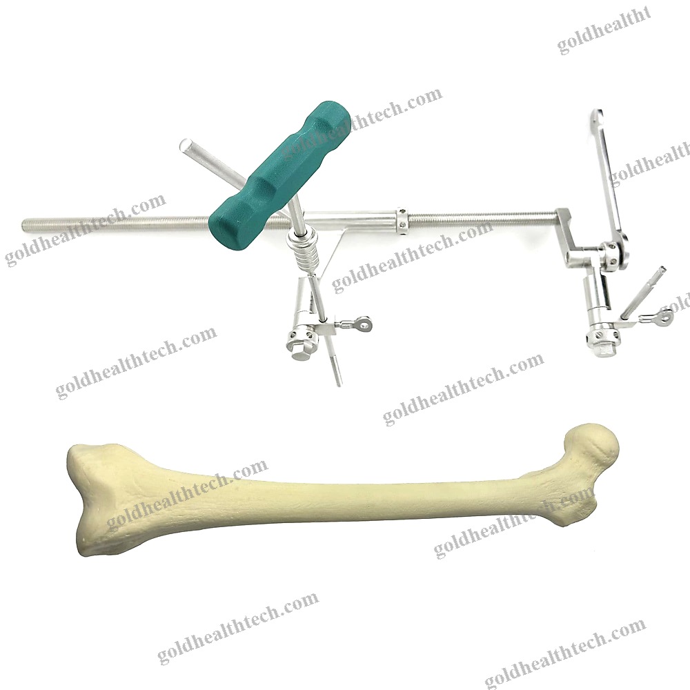 Mandibular Distractor