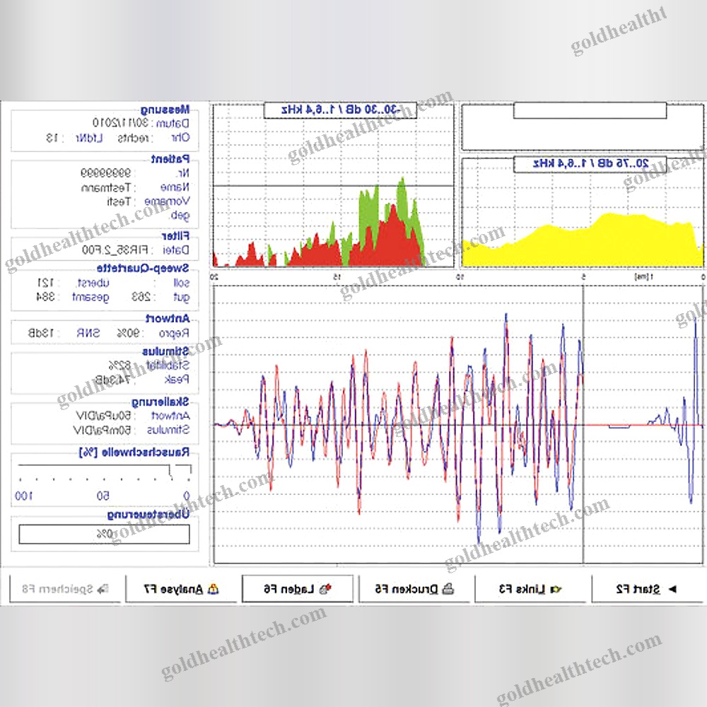 Oae Screening System