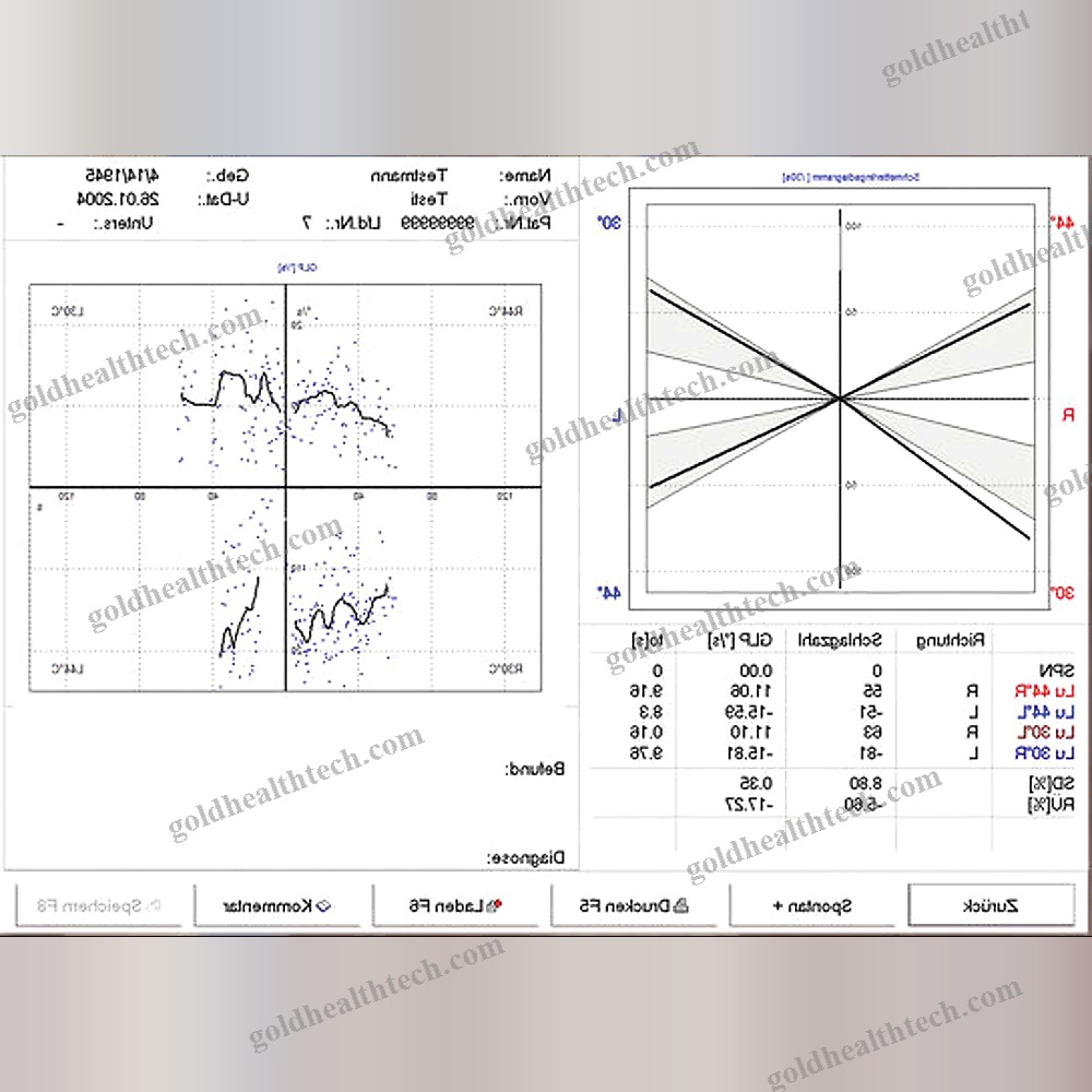 Electronystagmography Systems