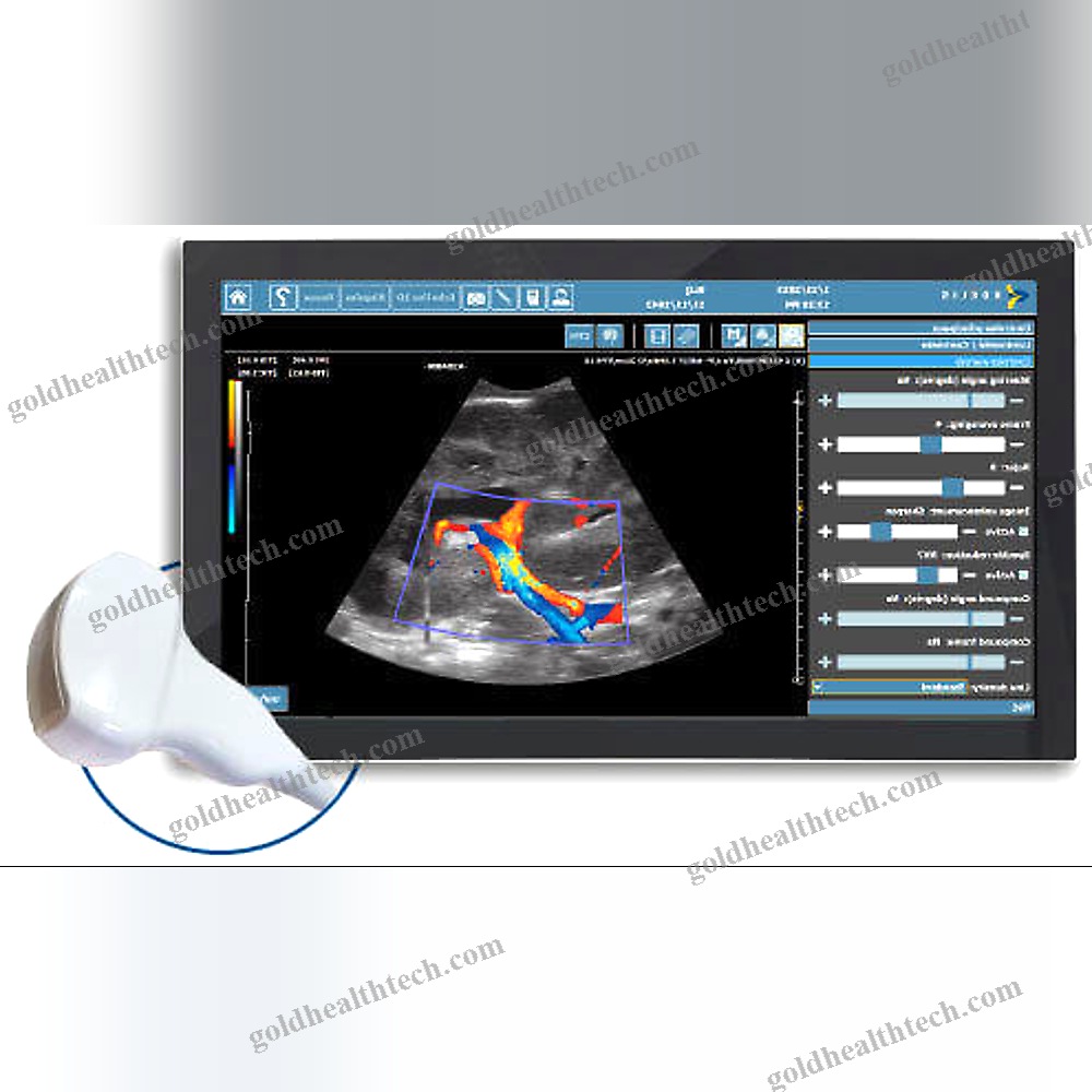 On-Platform Ultrasound System