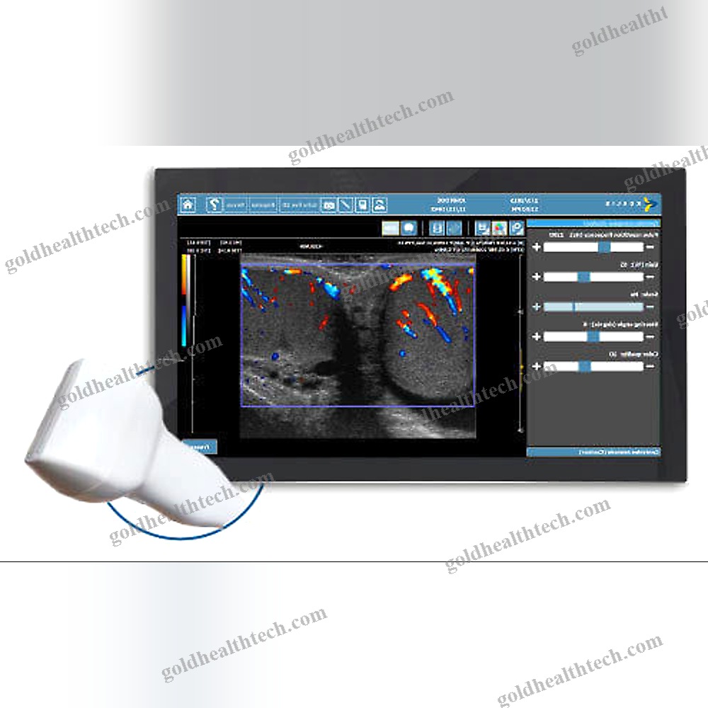 On-Platform Ultrasound System
