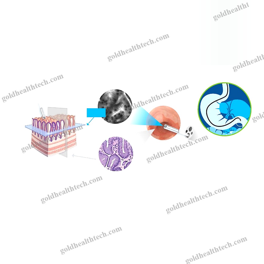 Cle Endoscopic Imaging System