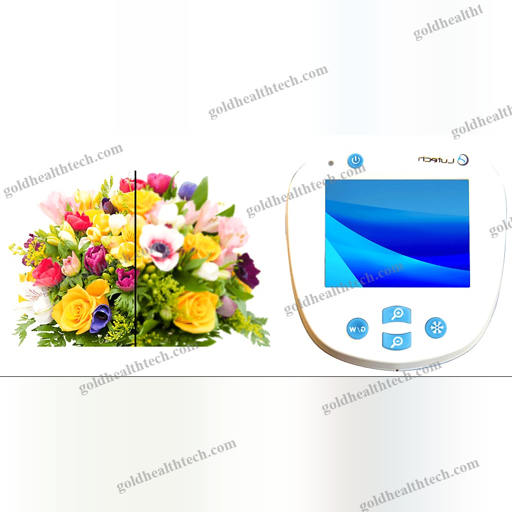 Video Colposcope