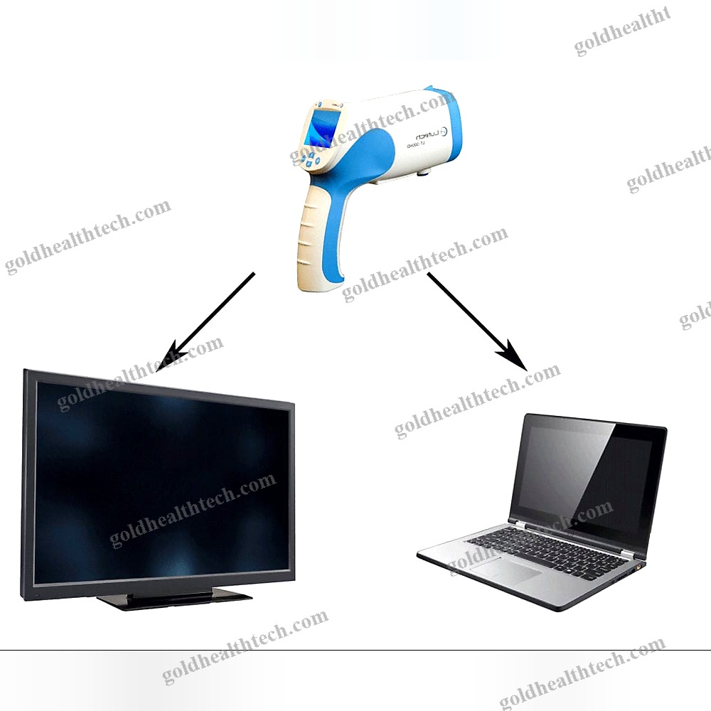 Video Colposcope