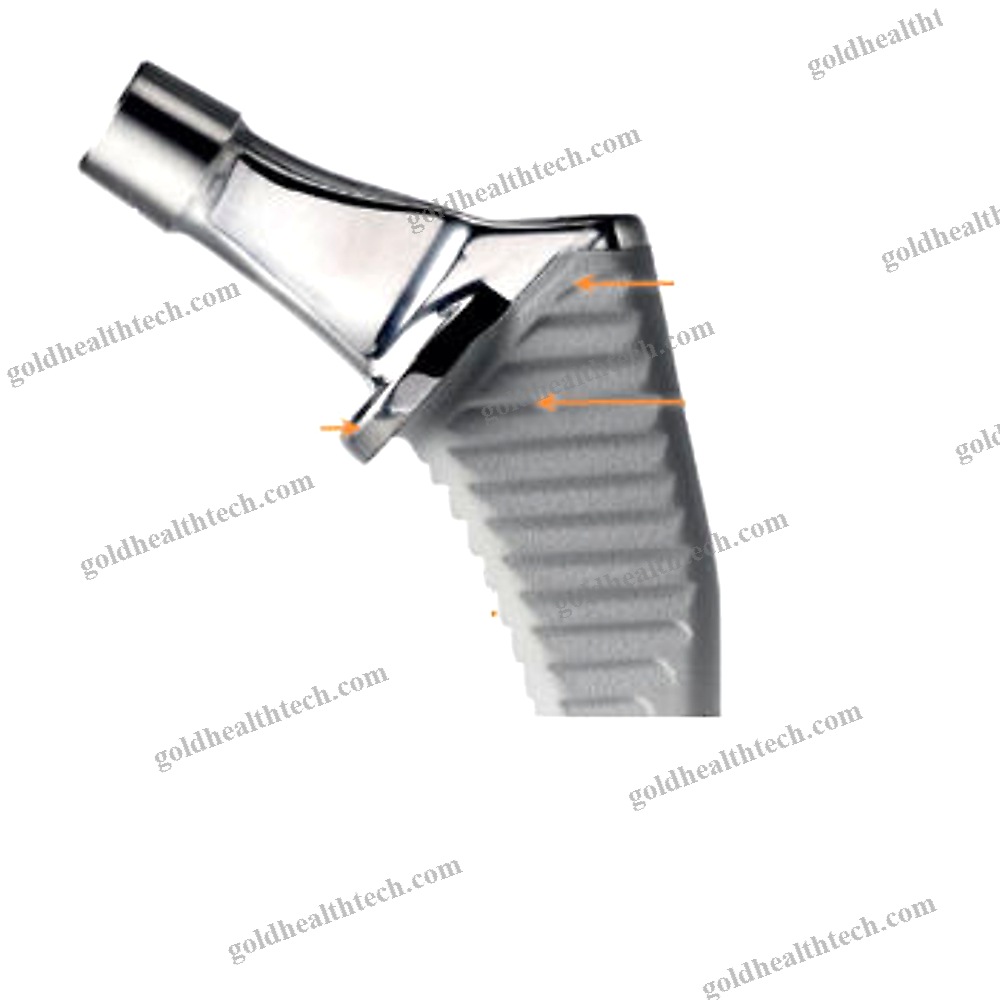Primary Hip Prosthesis