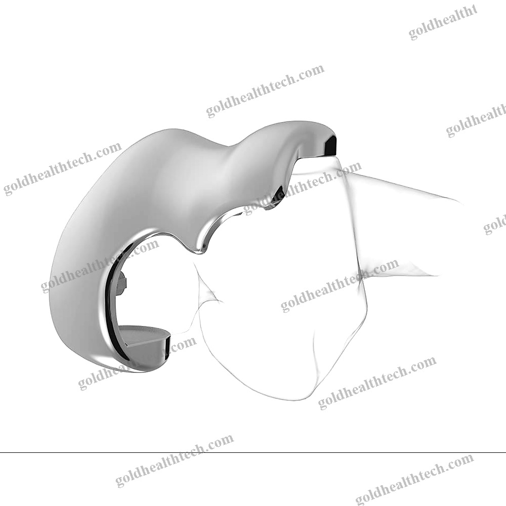 Unicompartmental Knee Prosthesis