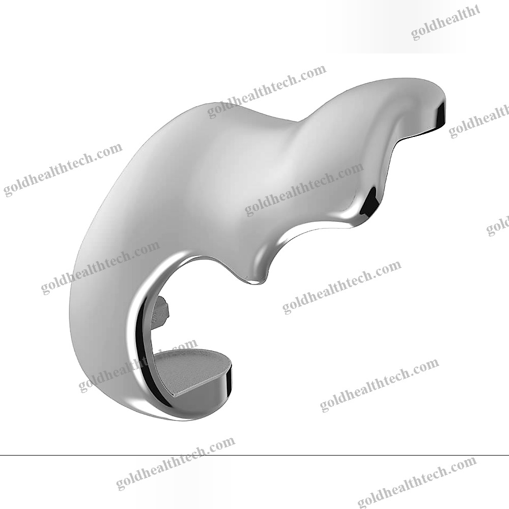 Unicompartmental Knee Prosthesis