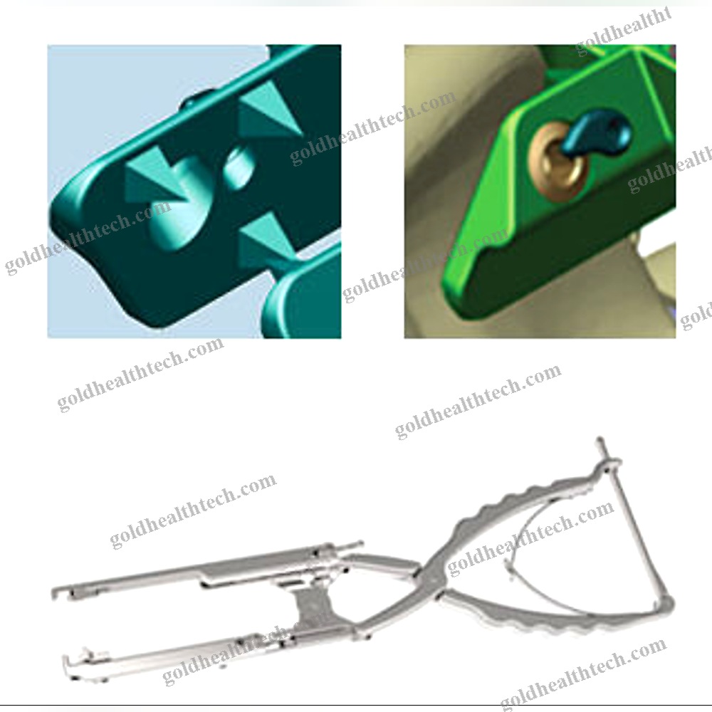 Lumbar Interspinous Vertebral Implant