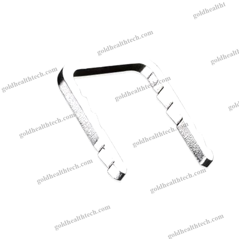 Forefoot Bone Staple