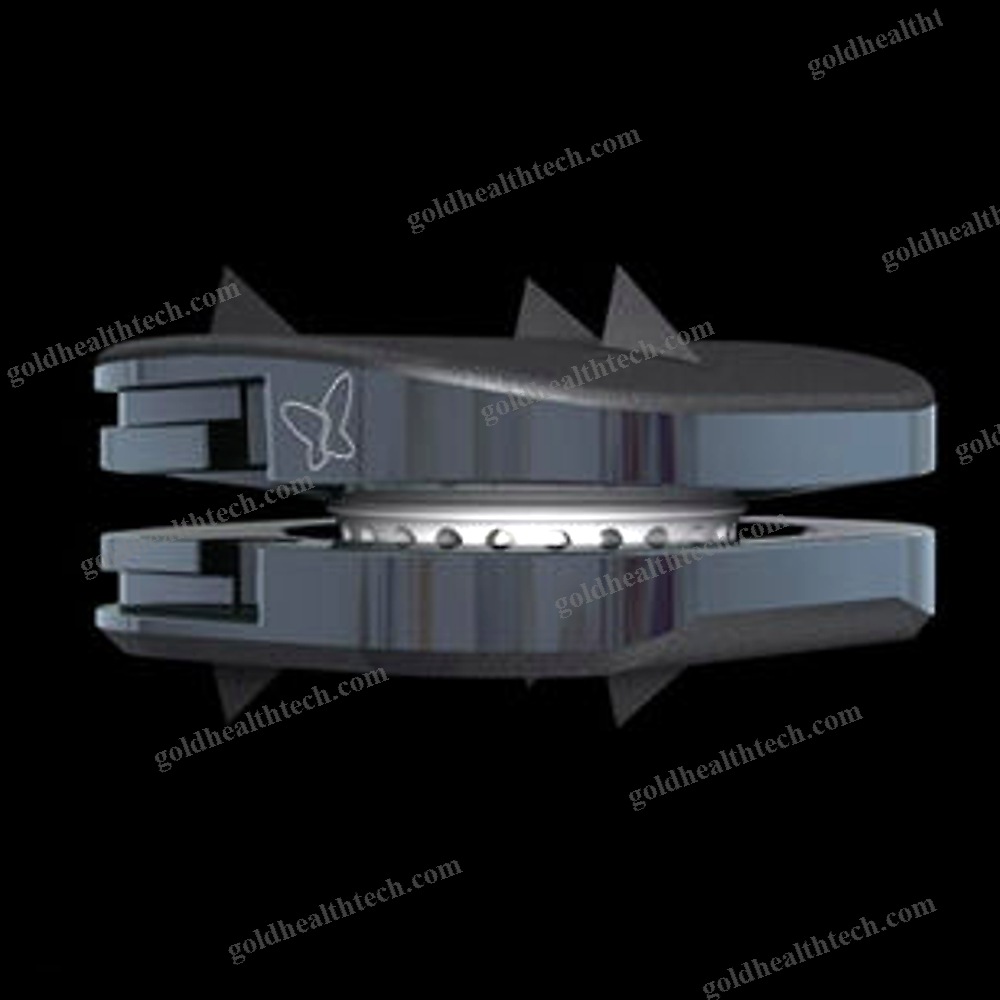 Cervical Disc Prosthesis
