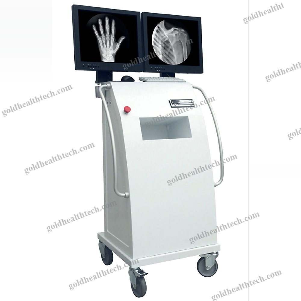 Mobile C-Arm