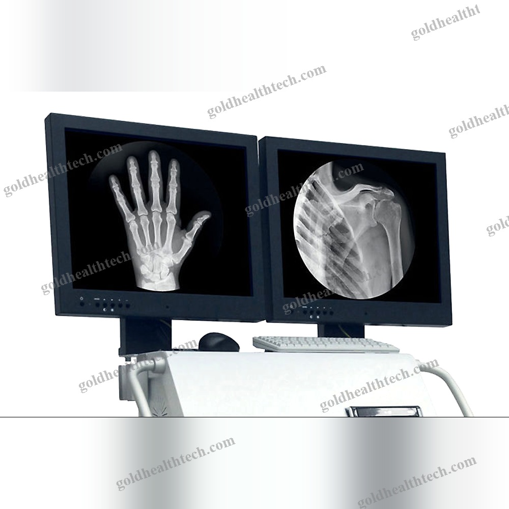 Mobile C-Arm