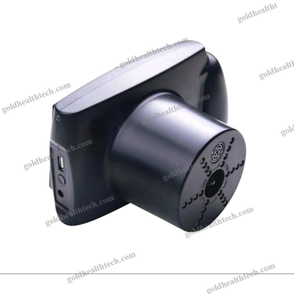 Video Pupillometer