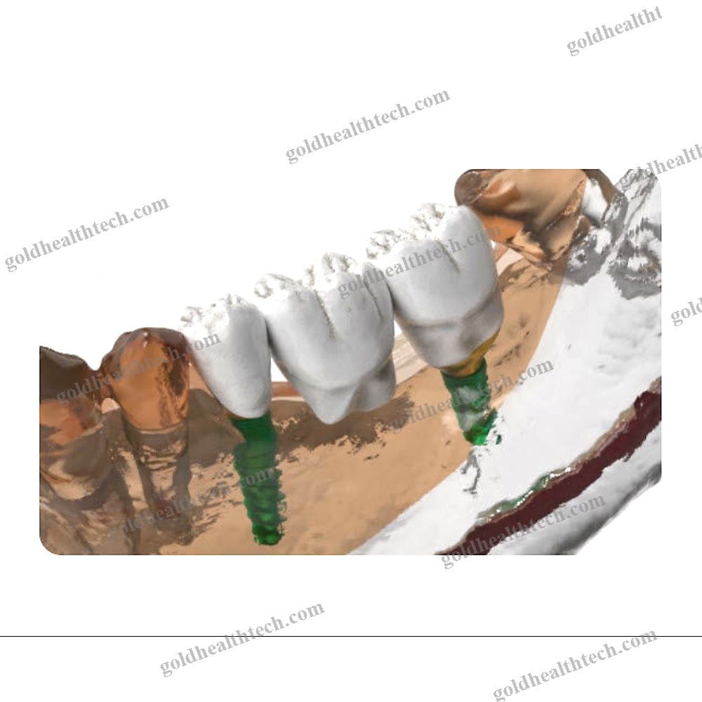 Dental Software