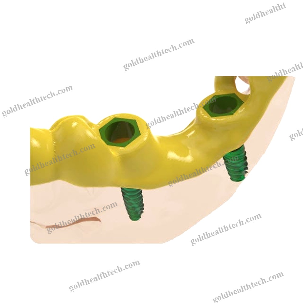Dental Software