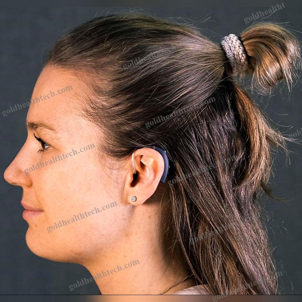 Bte Open Fit Hearing Aid