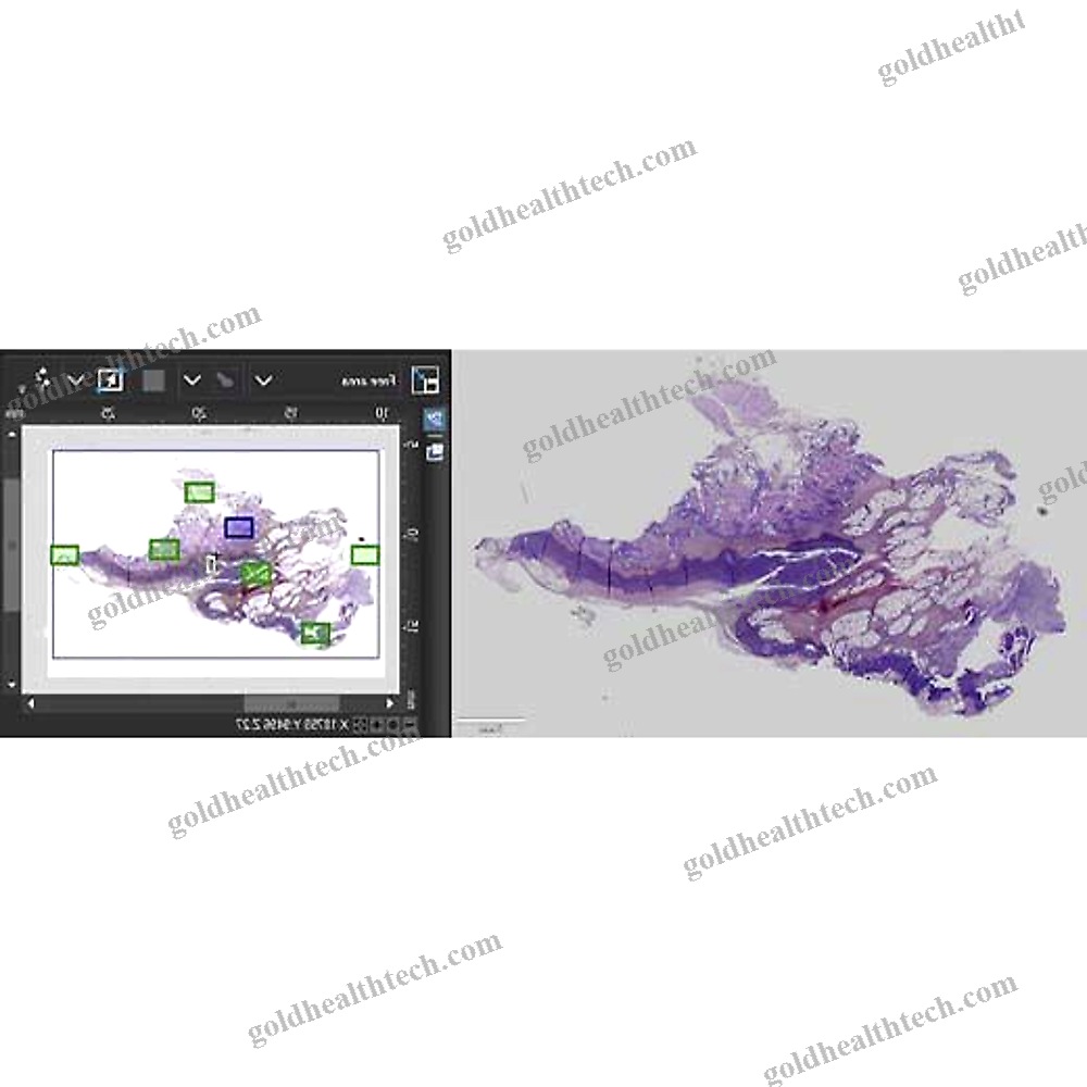 Digital Microscope