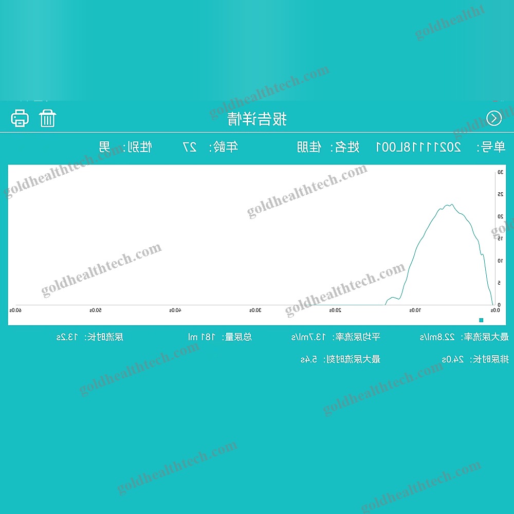 Computer-Based Urinary Flow Meter