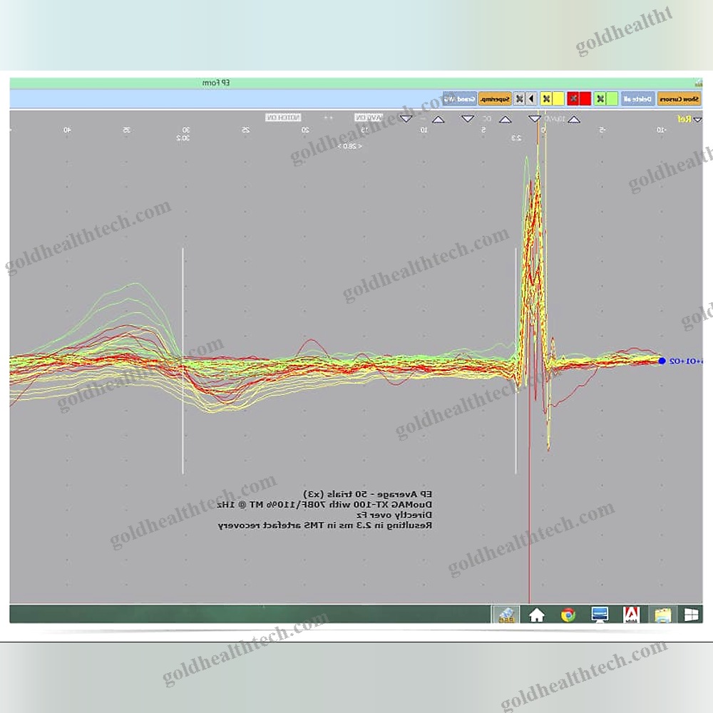 32-Channel Eeg System