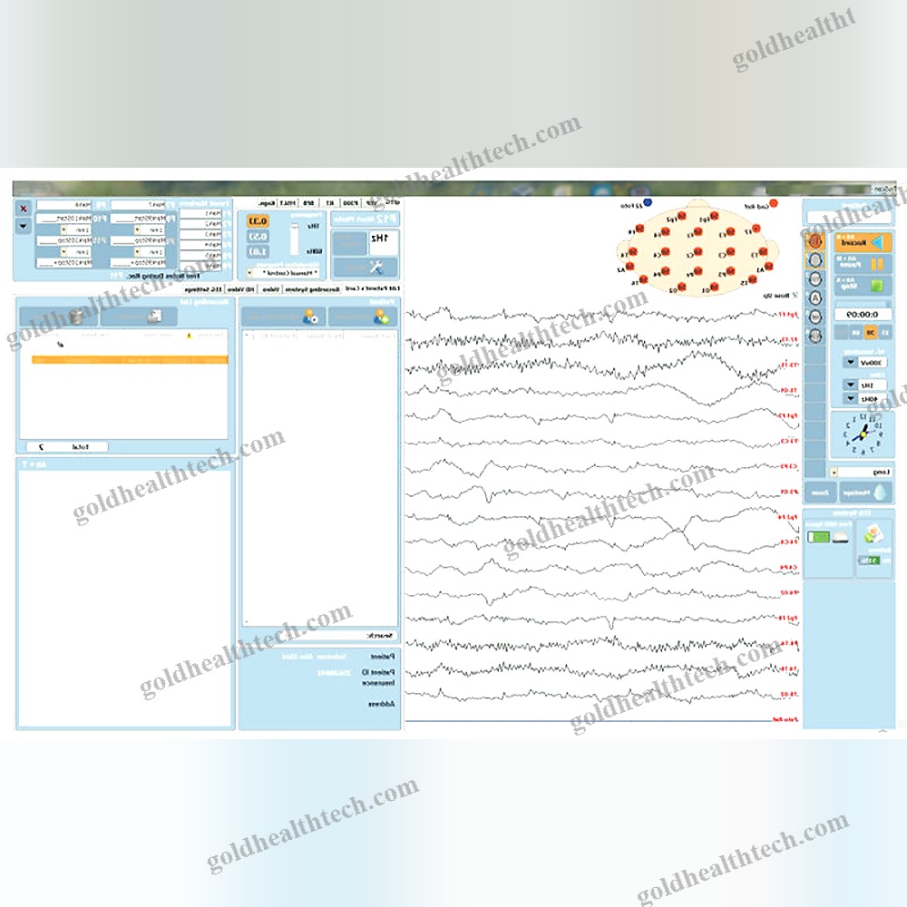 32-Channel Eeg System