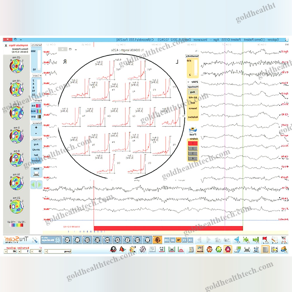32-Channel Eeg System
