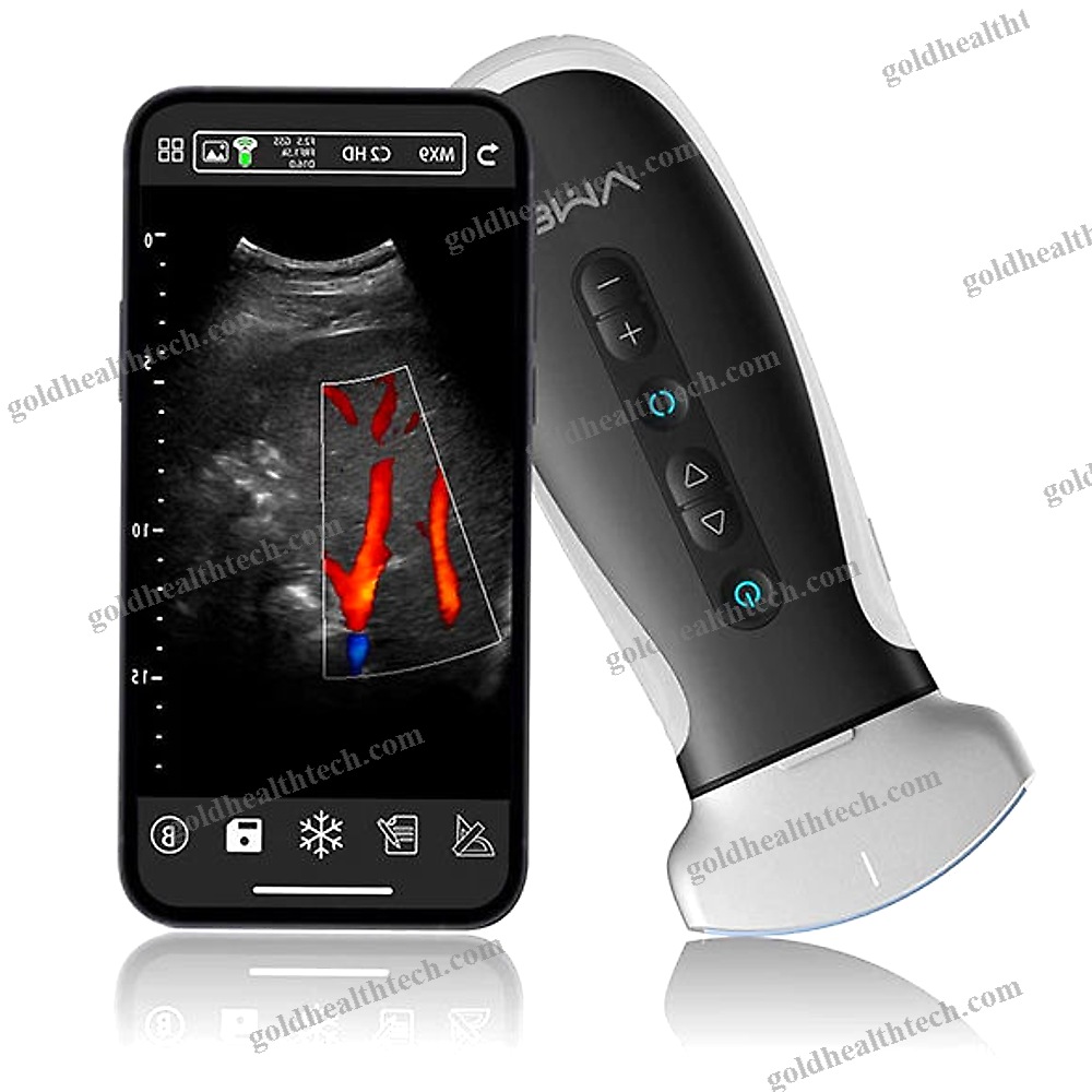 Hand-Held Ultrasound System