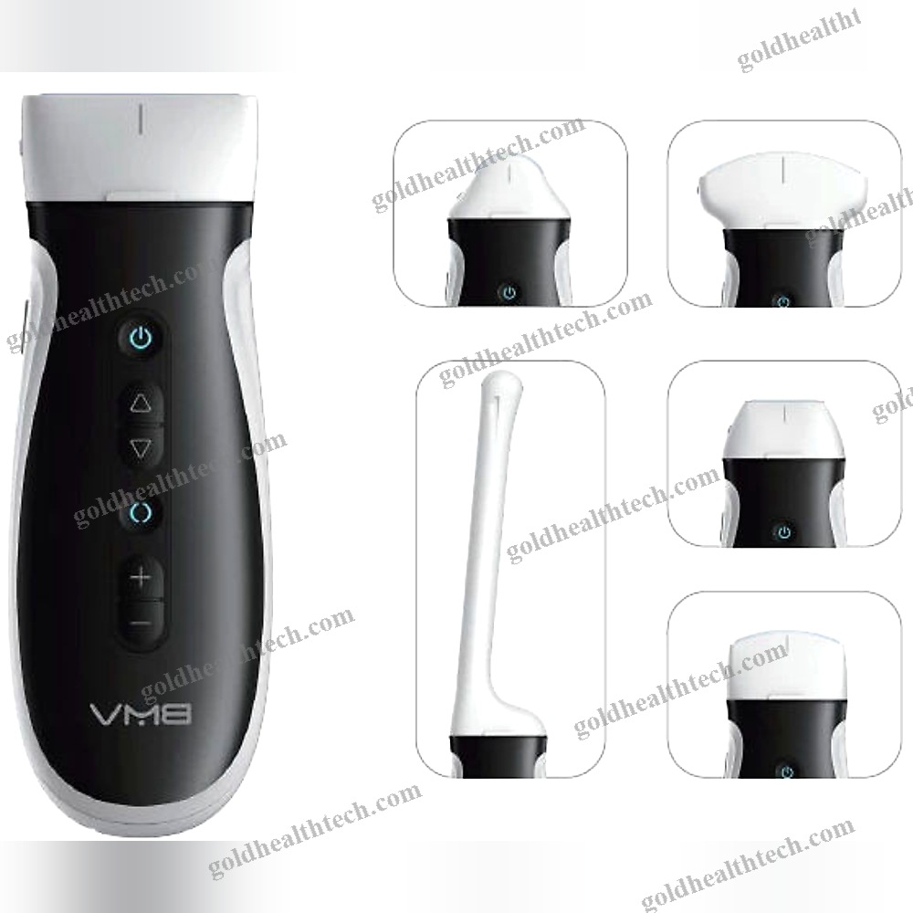 Hand-Held Ultrasound System